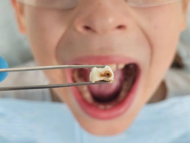 Best Emergency Treatment for Toothache in Enon, VA
